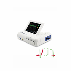 Moniteur Fœtal – Surveillance Cardiotocographique